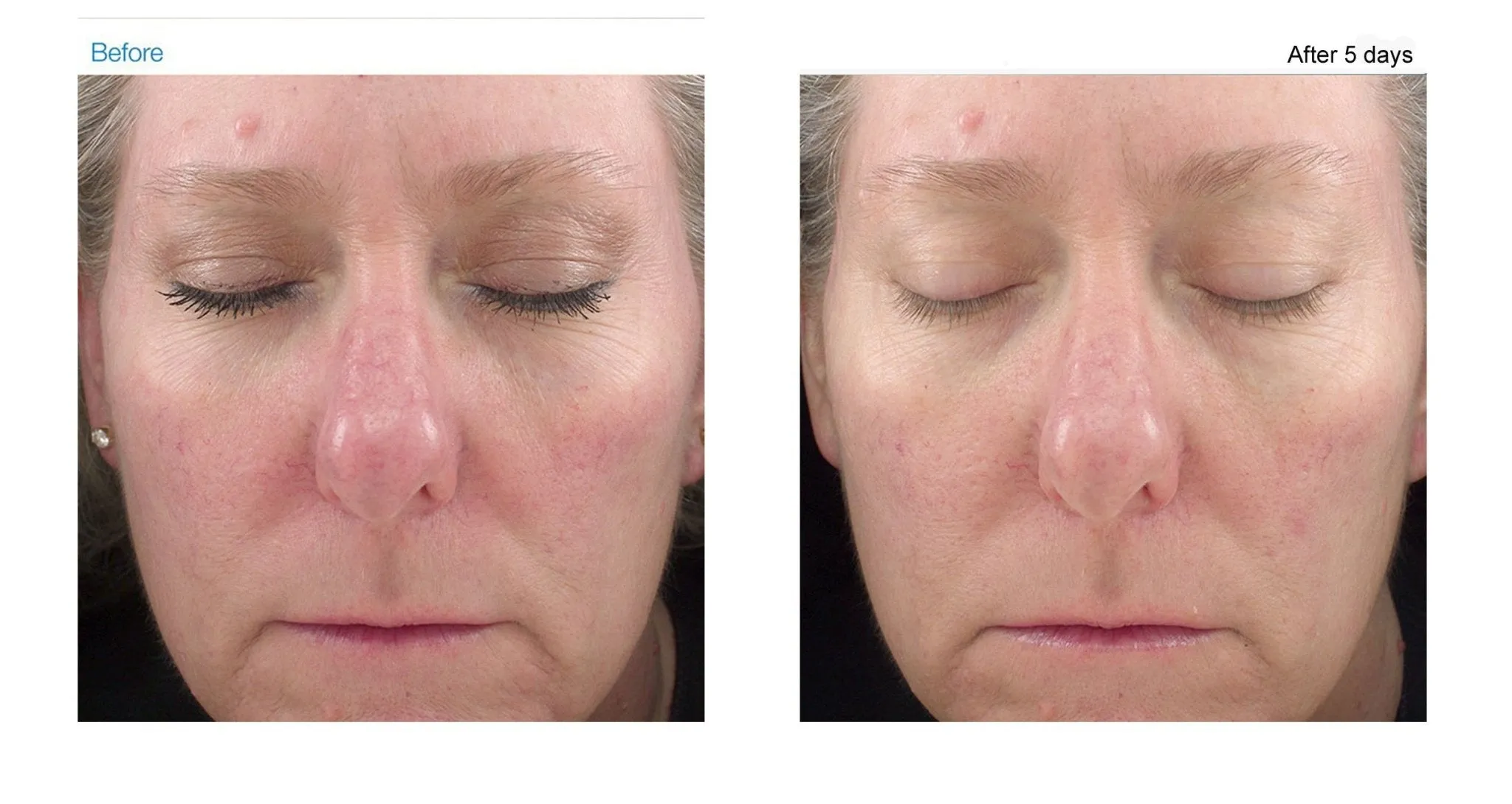 Rosalieve Redness Reducing Complex
